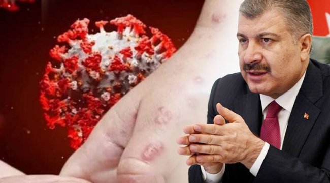 Eris varyantı Türkiye'de