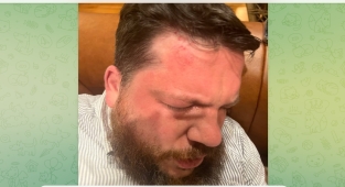 The former head of Alexey Navalny's Anti-Corruption Foundation was attacked