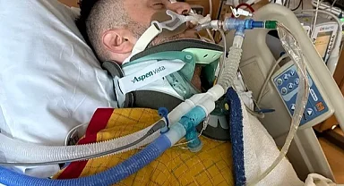 ABD’de trafik kazası geçiren Türk genci yaşam savaşı veriyor