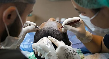 Sağlık Bakanlığı'ndan saç ekimi birimlerinde yeni dönem