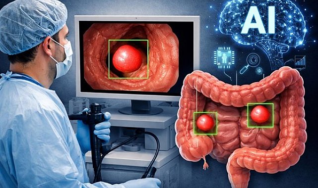 Yapay zeka kolonoskopide polip tespitini artırıyor